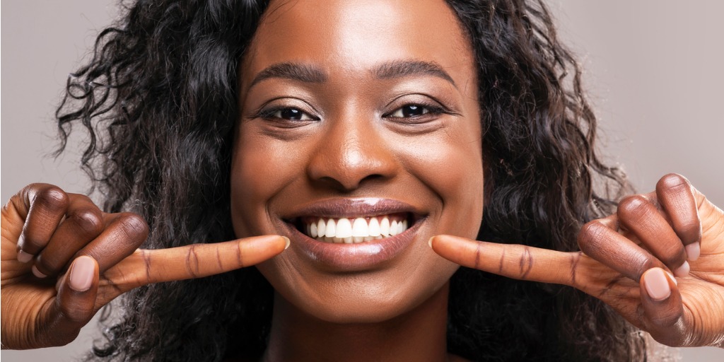 All White Teeth